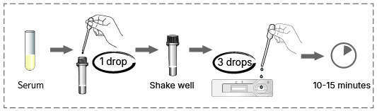 Brucellosis Test for Serum