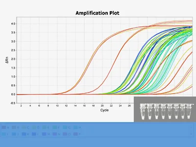 RT-PCR Test
